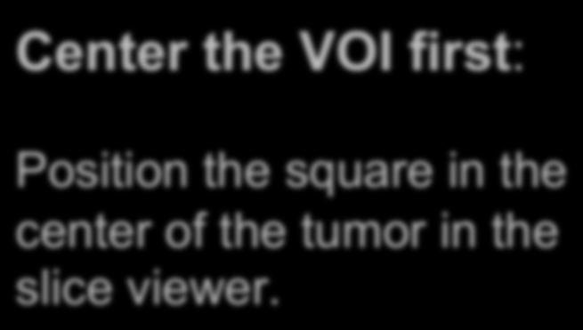 ChangeTracker: Step 2: Define a volume of interest A VOI Box Widget is positioned within the image volume in the 3D