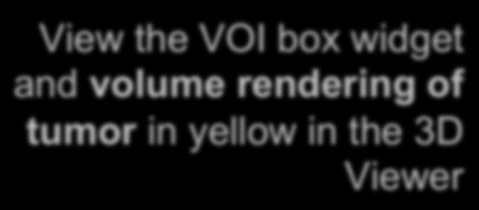 yellow in the 3D Viewer Next, resize the VOI: Use the