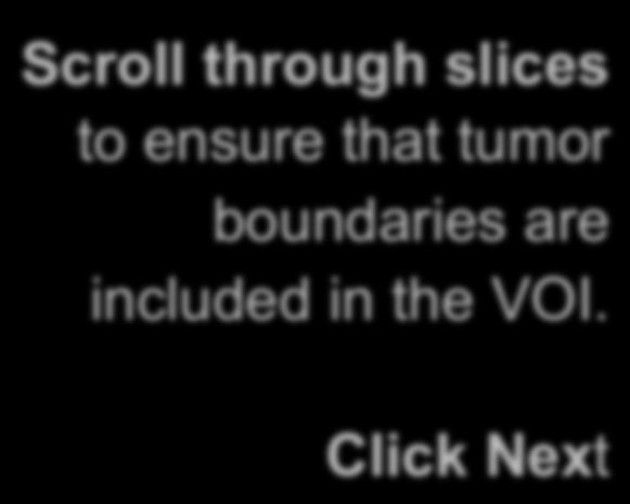 ChangeTracker: Step 2: Define a volume of interest Scroll through slices to