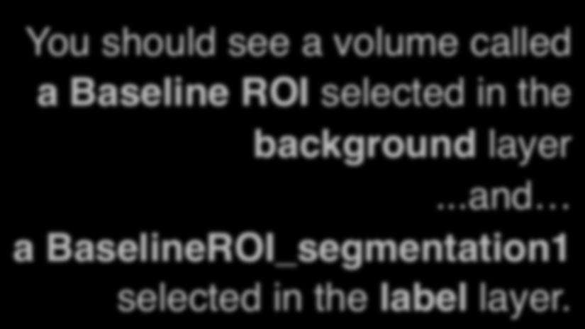 ChangeTracker: Step 2: Define a volume of interest You should see a volume called a Baseline ROI selected