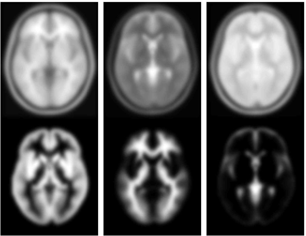 3.2. METHOD 17 Figure 3.7: Example template images. Above: T1 weighted MRI, T2 weighted MRI and PD weighted MRI.