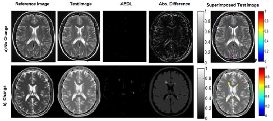 AEDL Algorithm for Detecting Changes in Medical Imaging 7 Fig. 5. Testing algorithm performance in the presence of different noise level. a) Reference image.