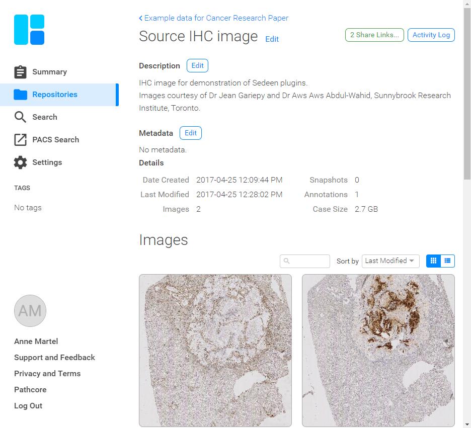 Curated Datasets Collect image databases Richly annotated by pathologists Develop ontologies Benchmark datasets Images