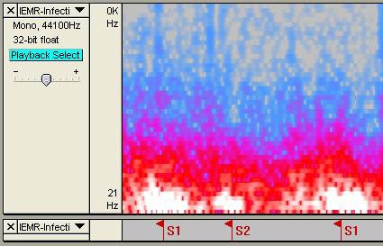 Turning Spectrgram n f ff can be dne using the Thinklabs Tlbar Display buttn, r the Tlbar Pulldwn Menu.It is als pssiblt t shw Spectrgram nly.