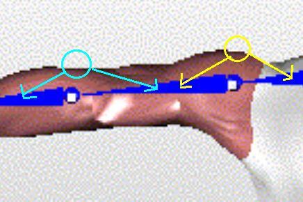 Problem 2: For some ponts, we don t know to whch body segment t belongs to For the ponts near the elbow