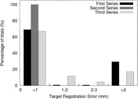 Cortical Surface Registration 539 Fig. 6. Distribution of Target Registration Error (TRE) for each series of experiments. Fig. 7.
