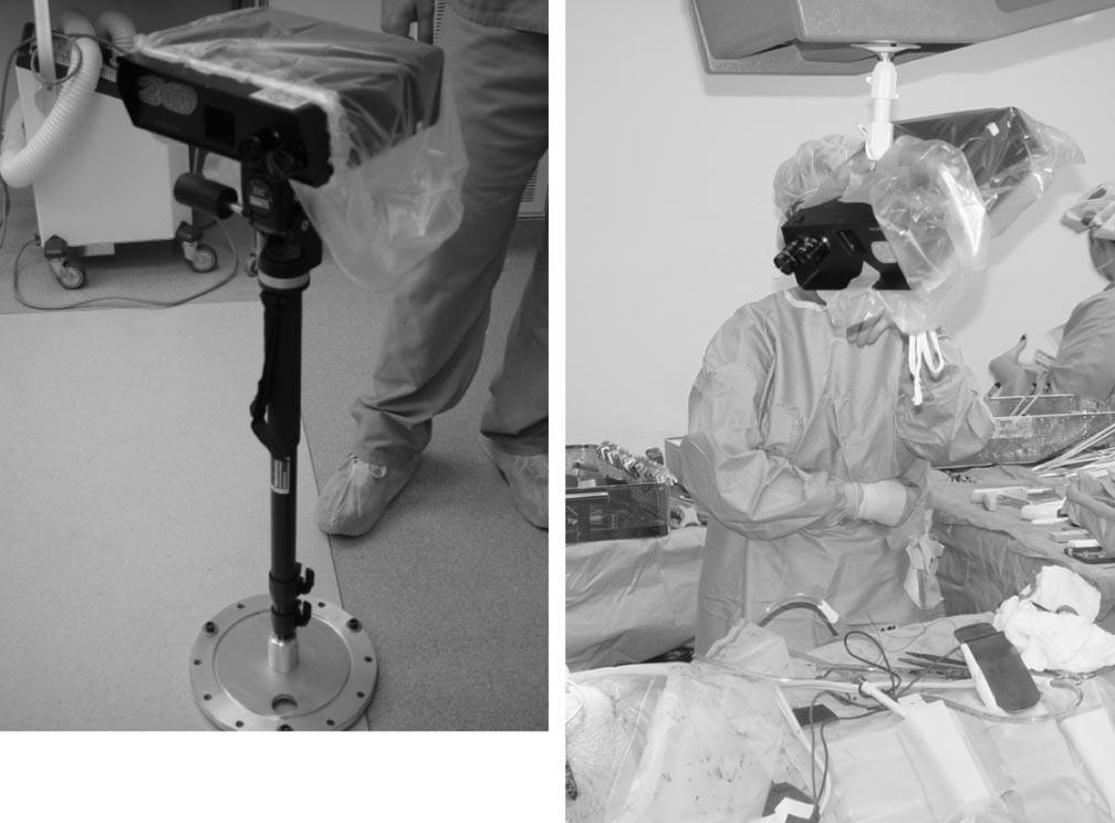 (b) LRS in the operating room covered with sterile isolation bag and mounted on custom built vibration damping monopod (shown here in collapsed state).