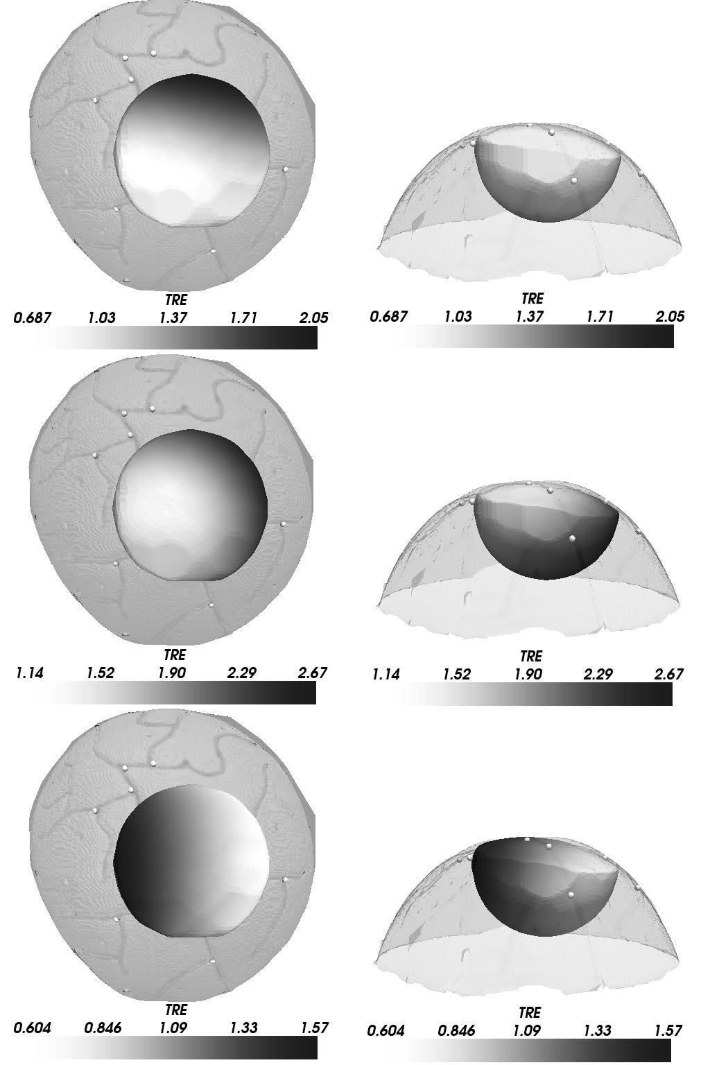 MIGA et al.: CORTICAL SURFACE REGISTRATION FOR IMAGE-GUIDED NEUROSURGERY USING LASER-RANGE SCANNING 981 Fig. 9. Three-dimensional distribution of TRE for deep tissue targets.