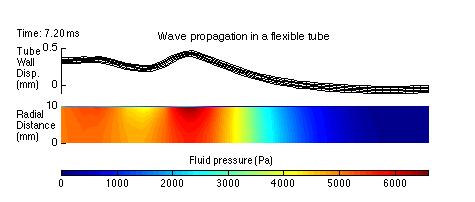 Fluid-Solid Coupling Coupled Fluid Flow and Stress Analysis Simulations Loose coupling: Fluid and solid solved in