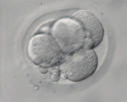 We discuss experimental results on a dataset of 40 embryo images, and expand on the advantages and drawbacks of our method while comparing our method to other approaches.