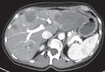 CT IMAGE DEPENDS ON THE X-RAY ENERGY CT IMAGE DEPENDS ON THE