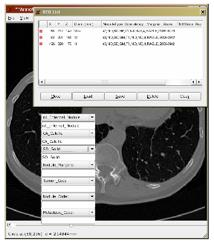 CT scans in the DB Annotation by 2 to 4