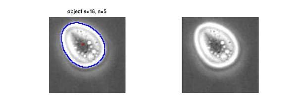 Figure 4: Library of images (upper row: cysts, lower row: amoeba) The user can also employ the viewing tools to obtain data, measurements, confidence statistics and images for individual objects.