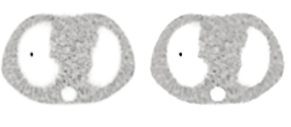 weighted axial filter. images reconstructed with β=350 and no post filtering.