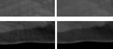 Left and right columns represent the image regions before and after processing, respectively. (a) (b) (c) (d) Figure 4.8.
