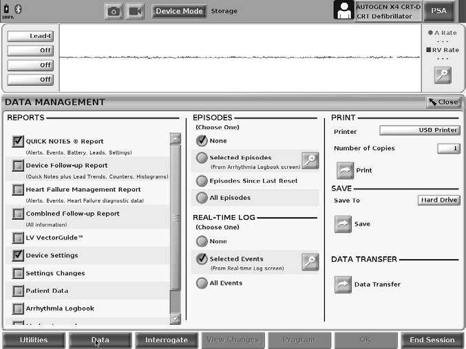 PRINT, SAVE, AND TRANSFER DATA FROM A PG OR PSA SESSION This section describes how to Print, Save, and Transfer patient data while in a PG or PSA session.