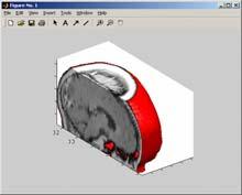 Matlab: visualization Matlab: GUI 2D display imshow imagesc 3D surface rendering isosurface,, patch isocaps, isonormals Guide Matlab: more Matlab code can be integrated/reused: Matlab