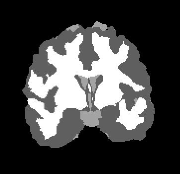 Methods used in (b) and (c) do not allow the parcelation of cortical substructures.