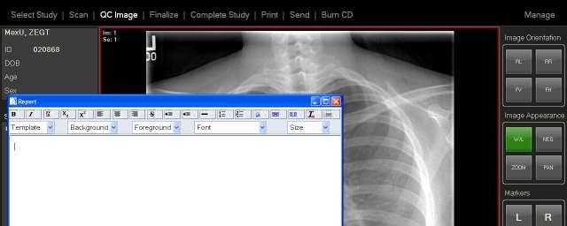 Report editing using IE browser (Con t) To enter notes on a specific patient: 1. Select the desired study and view it in the QC Image window 2.