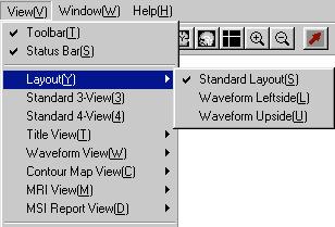 8.3 Layout The main window to display the MEG data file has five zones. They are: title, waveform viewer, isofield contour map, MRI viewer, and magnetic source report.