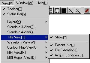 8.4 Standard 3-View Title, waveform viewer, isofield contour map, and MRI viewer are shown. This set is called the standard 3-view arrangement. 8.