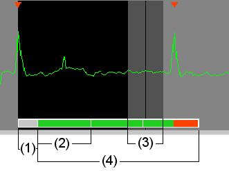Physio - Signal 1 A.6 Displaying the time domain Displays the physiological signal as well as the time domains resulting from the parameters set.