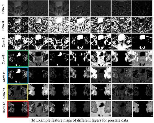 Fig. 11. Examples feature maps in each convolutional layer for the case of synthesizing prostate CT image. These feature maps are sort by descending order according to their SMI values.