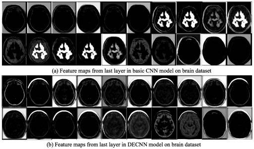 Fig. 12. Feature maps learned from last layer by CNN and DECNN on both brain and prostate dataset.