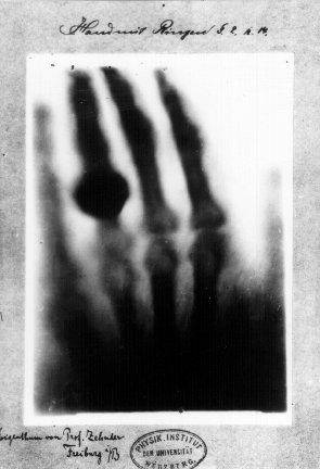 2. Computer Scientific Background (a) X-ray of hand. (b) Wilhelm Conrad Röntgen. Figure 2.2.: (a) X-ray image of Anna Berthe Röntgen s hand.
