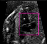 Temporal HeartNet: Automatic Analysis of Fetal Cardiac Screening Video 5 Fig. 2: GT and predicted maps for IoU layer. Left: rescaled input image.