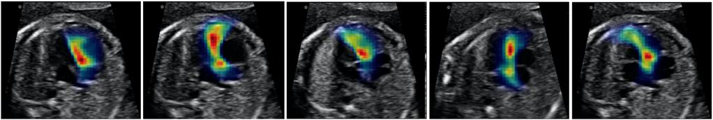 Temporal HeartNet: Automatic Analysis of Fetal Cardiac Screening Video 7 Fig.