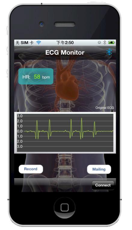 4. WIRELESS CARDIAC MONITORING SYSTEM ISSN 2278-3091 The developed wireless ECG monitoring system has all the good properties of the three mentioned recorders and even the right properties for
