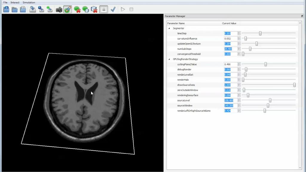 White and gray matter MRI T1 and T2 Size: 181x217x181 KNN-based speed function for surface