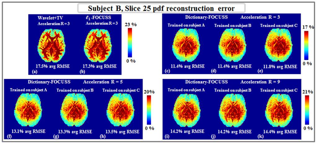 Bilgic et al. Page 11 Fig. 2. RMSE at each voxel in slice 25 of subject B upon R = 3 acceleration and reconstruction with Menzel et al.