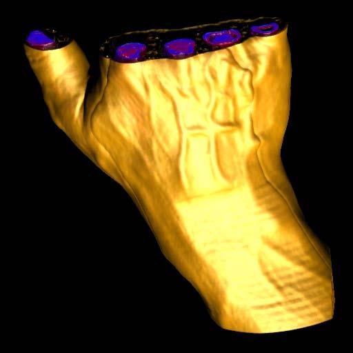 (top, right) skin with contour rendering, vessels with shaded DVR, bones