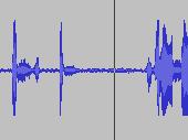 Click the mouse in the waveform after the cough to position the cursor (See Figure 7) 3. Click the Play button The waveform plays from the cursor to the end 4.