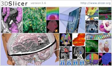 The Slicer3 Software An end-user application for image analysis An open-source environment for software