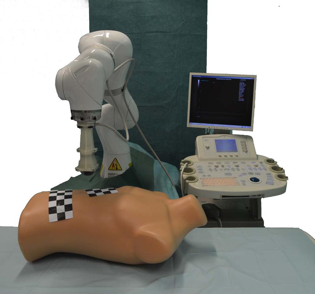 2 robot arm ultrasound system probe mount examination bed Fig. 1.