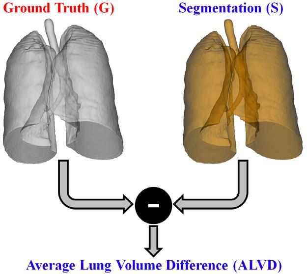 seen in Figure 20: P V D = 100 (ctp+c fn) (c tp+c fp ) c tp+c fn 100 G S G (16) FIGURE 20: 3D schematic illustration for the absolute lung volume difference (ALVD) estimation. 4.