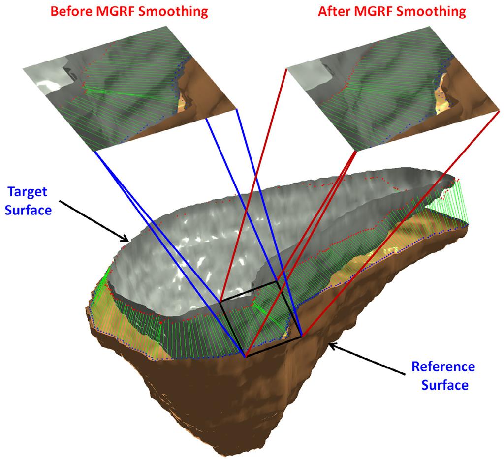 Figure 35 that the voxels correspondences before applying the GGMRF regularization have some intersections, specially in the concavity regions, that contradicts the anatomy preservation.