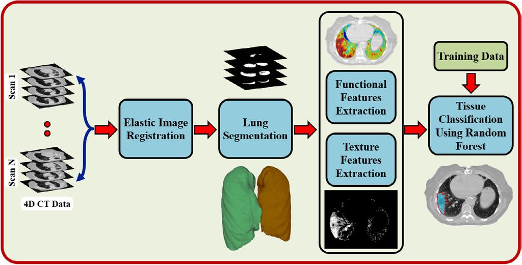 FIGURE 41: Processing pipeline framework for detecting the radiation-induced lung injuries (RILI). 3D-CT volumes from the peak exhale phase to the peak inhale phase.