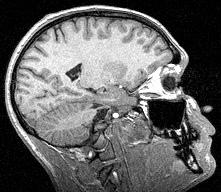 Brain MRI Kidney CT image Fetus US image Lung PET image Liver SPECT image FIGURE