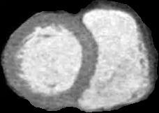 Administering contrast agents before a CT scan helps in acquiring finer image details.