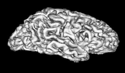 After removing the scalp from the head images, using the raw image of the cortex, the CSF and the cortex is segmented.