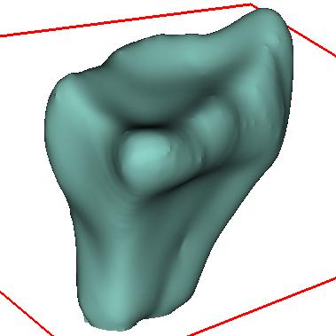 (d) The final 3D segmentation after 3 more active queries were labeled.