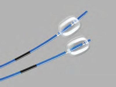 Biliary/Pancreatic - Extraction Tri-Ex Triple Lumen Extraction Balloon Used for endoscopic removal of biliary stones. Part Balloon Balloon Volume cc Injection Port G22530 TX-8.5-A 7-5 200 8.5 1.5.035 G22531 TX-8.