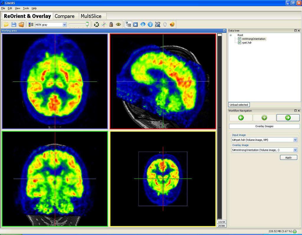 This section contains a PET and a MRI image. b. Render both images by checking them in the Data Tree. c. Press Ctrl+A to di