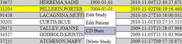 13 3.6 CD Burn 1. Right click on the study/patient you wish to burn to a CD. A dropdown menu will display, as shown in Figure 3.12. Figure 3.12 2. Click CD Burn (See Figure 3.13. below) Figure 3.13 3. Insert a blank CD into the workstation disc drive.