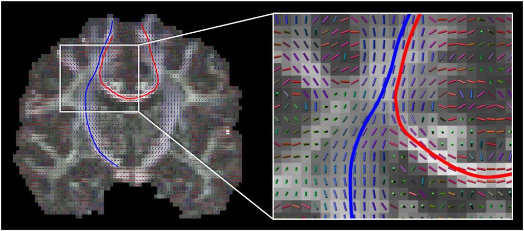 JEURISSEN ET AL. 3 of 22 FIGURE 1 Vector field of local predominant fiber orientations and two of its streamlines depicted on a coronal view of the human brain.