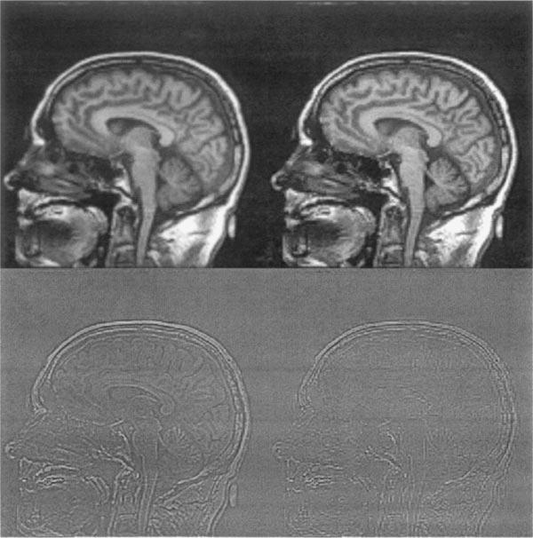 370 GUOPING QIU FIG. 7. MRI image reduced and then expanded by a factor of 2 (256 256 to 128 128 and 128 128 to 256 256).